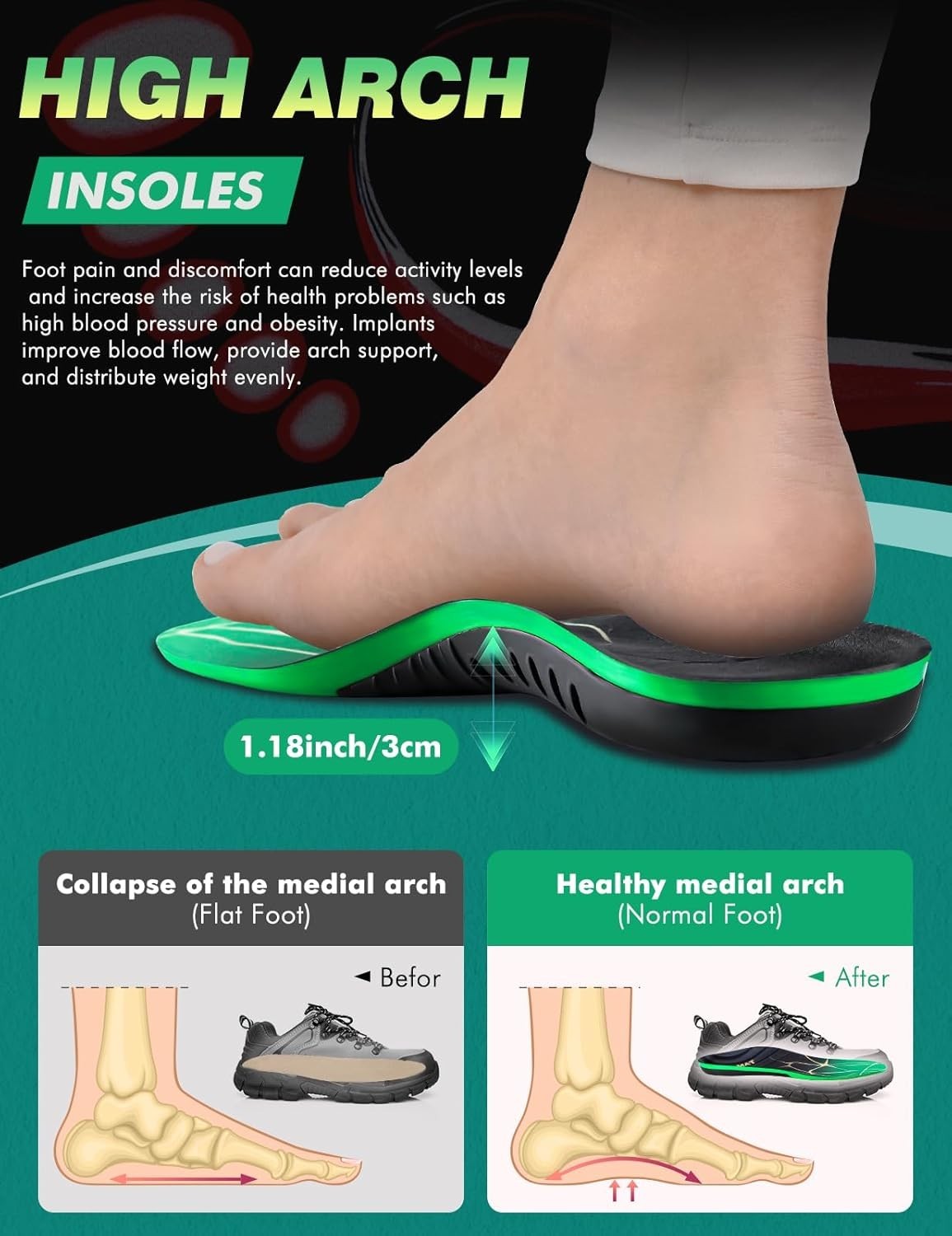 Plantar Fasciitis High Arch Support Insoles for Men Women, Arch Support Inserts.