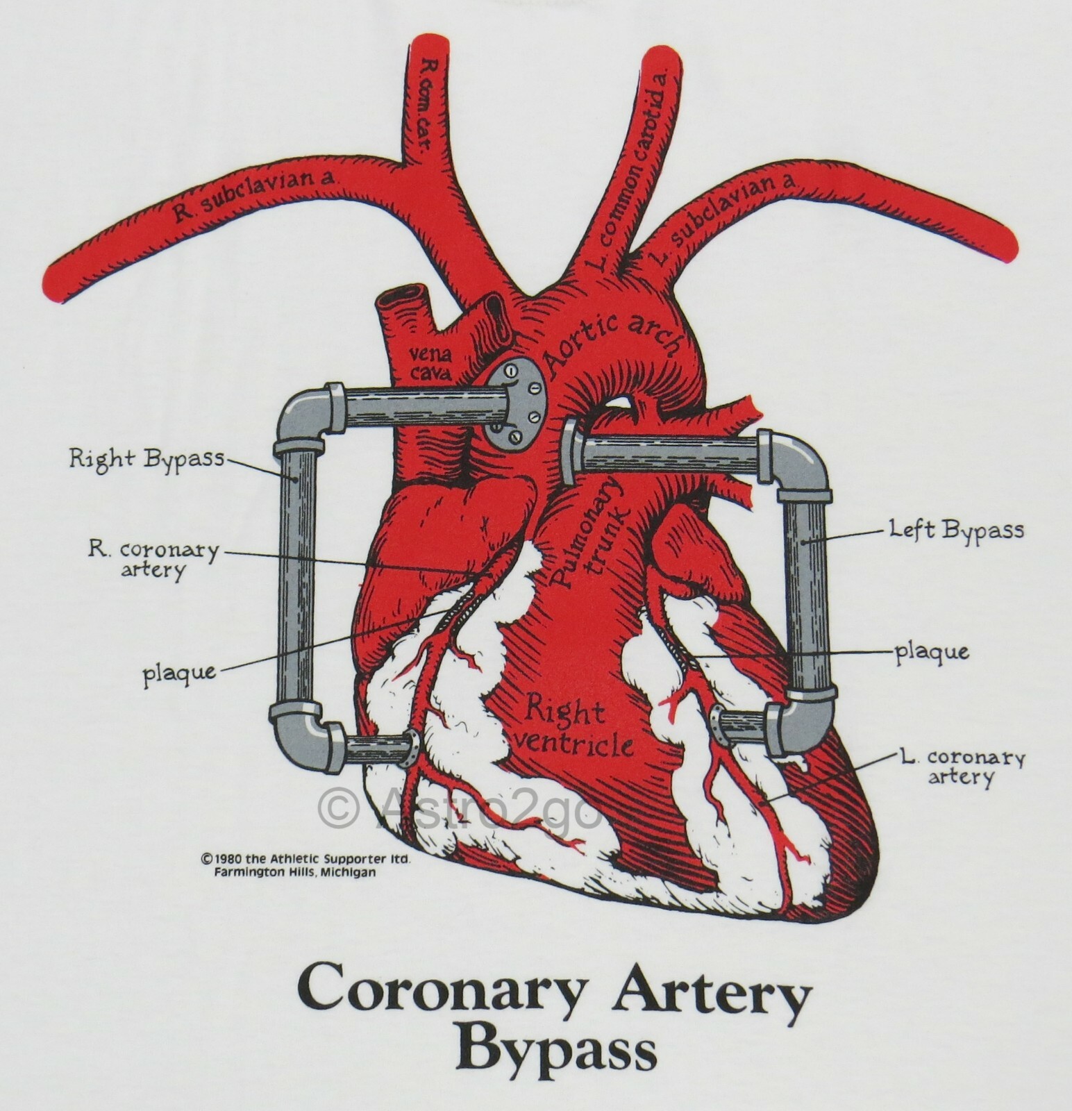 CORONARY ARTERY BYPASS-Leslie Arwin Heart Disease Anatomy Biology T shirt S-2XL