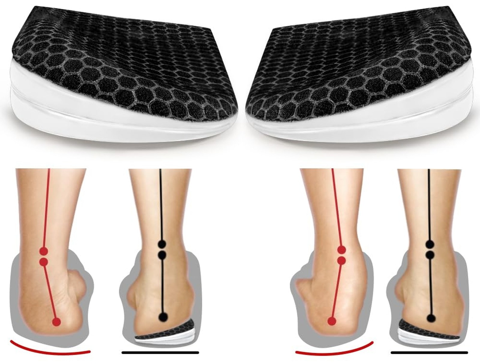 BIGGCOOL Corrective Insoles for Supination & Over-Pronation, Orthotics Medial…